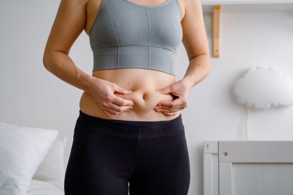 Diastasis Rectus Abdominis (DRA) 3 a woman showing her imperfect body a belly with s 2024 10 18 03 40 36 utc